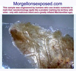 morgellons